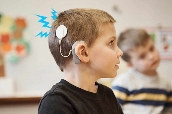 Speech Therapy for Cochlear Implant