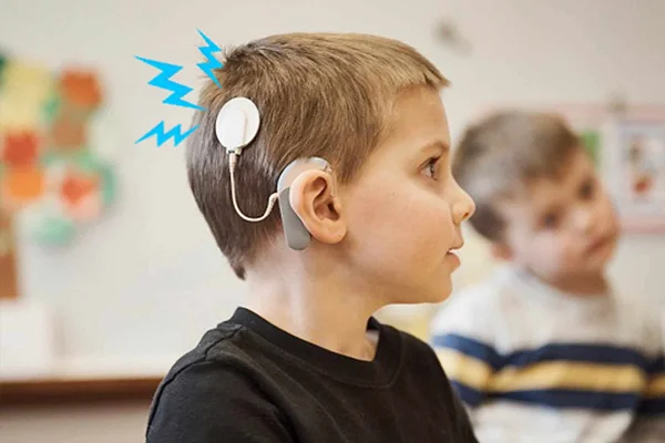 Speech Therapy for Cochlear Implant
